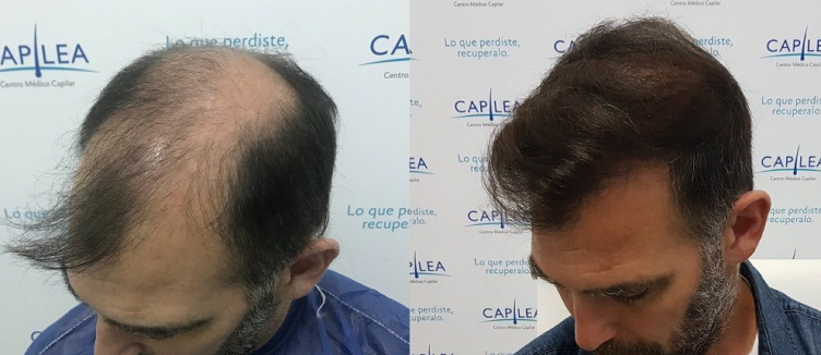 image-nota-4a